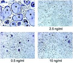 Wong& partners dental surgeons, bandar baru sri petaling. Interleukin 4 Reversibly Inhibits Osteoclastogenesis Via Inhibition Of Nf Kb And Mitogen Activated Protein Kinase Signaling Journal Of Biological Chemistry