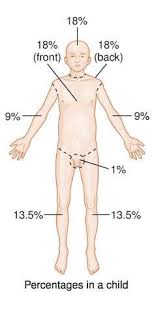 Rule Of Nines Definition Of Rule Of Nines By Medical