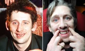 Everest of dentistry': Shane MacGowan gets new teeth in TV special