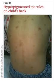 Image result for Wheal