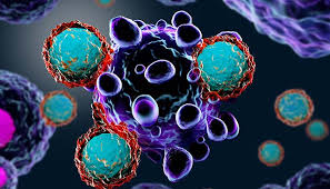 This cancer is largely preventable through screening and treatment of premalignant lesions. Immunotherapy For Cervical Cancer Treatment Moffitt