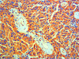 The camel's nose is a metaphor for a situation where the permitting of a small, seemingly innocuous act will open the door for larger, clearly undesirable actions. Brain Tumours In Two Bactrian Camels A Histiocytic Sarcoma And A Meningioma Molenaar 2009 Veterinary Record Wiley Online Library