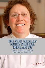 Amazon.com: Do You Really Need Dental Implants?: 9781481171960: Rementer  DMD, Marcia L., Raczkowski PhD, Denis: Libros