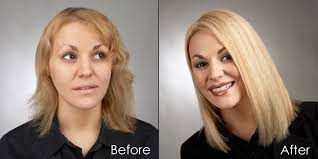 From hair loss to headaches, be it for thin or thick hair, there is an underlying opinion that hair extensions are not safe. Are Extensions Safe For Your Hair Salon Nadwa Hair Loss Center