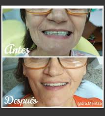 Clinica Dental Sonrisa Ojeda (@clinicadentalsonrisaojeda) • Instagram  photos and videos