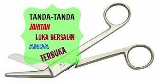 Tak semua ibu bersalin akan mendapat luka yang teruk. Mommy Ceria Tanda Tanda Jahitan Episiotomi Anda Terbuka Dan Komplikasinya