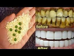 Tips menghilangkan karang gigi dan memutihkan gigi gak sampe 10rb! Pin On Hair Style