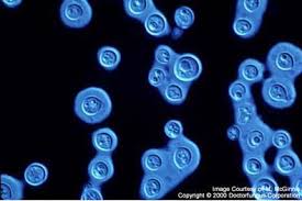 Busse isolated the yeast from the. Cryptococcus Neoformans