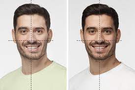 Tmj treatment and bite adjustment studies have found that even four degrees of tilt are visible to 90% of casual observers. Dental Treatments Can Fix Asymmetrical Face Cosmetic Dentistry