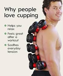 Amazon.com: REVOMADIC REVO The Original 4-in-1 Smart Cupping Massager with LED Light, Heat, Dynamic Suction & Vibration Massage, Portable Cordless Rechargeable Cupping Device for Body-2 Pack : Health & Household