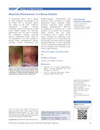 Image result for Nevus Simplex
