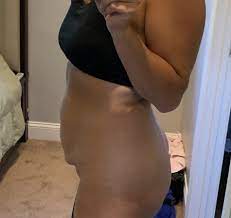 Getty images/ @natabeleebfitness not easy, fast get a rid, excess the upper public fat in upper public bone areas, but i many research, how … Can I Lose This Fupa With Exercise Or Should I Get Surgery Babycenter