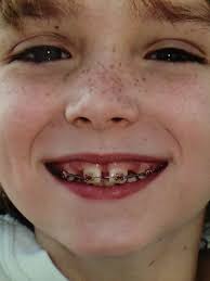 How to apologize: 4 lessons from childhood that still apply