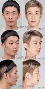 Brroooo I M Scared To Go To Korea Now Lol Trustissues Plastic Surgery Male Plastic Surgery Plastic Surgery Korea
