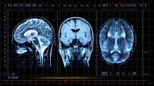 • it is difficult to manage sorting manually, whereas, some bibliography styles sort entries in alphabetical order automatically. Latex Bibliography Not In Alphabetical Order Speech Order In Britain Www Amphitheateroperations Com