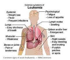 The lymph nodes in the groin are also called femoral or inguinal lymph nodes. Roles Of Malaysian Online Newspapers In The Construction Of Public Opinion On Rare Earth Risks Published In Asian Journal For Public Opinion Research