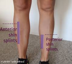 Prevent Shin Splints Shin Splints Massage Therapy Running Workouts