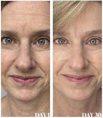 Kathy Covers Experiance With Collagen Elixir