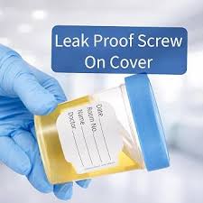 Amazon.com: Vakly Sterile 4 oz Specimen Cups with Leak-Proof Lids for Lab Testing, 5 PK | Individually bagged, clear polypropylene, graduated volume markings, urine, stool and specimen collection with ID label :