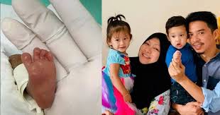 Bahagian usus (biasanya dilihat dengan peritonitis) buah pinggang (jangkitan pada saluran kencing atau pyelonephritis) lapisan otak (meningitis) hati atau pundi hempedu Meningitis Jangkitan Kuman Dalam Darah Radang Paru Paru Boleh Menyebabkan Maut Pada Si Kecil Doktor Ini Kongsi Punca Tips Pa Ma