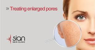 Enlarged Pores Treatment At Sian Skincare Laser Clinic Vietnam