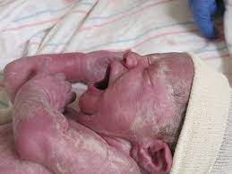 32 Weeks Nora S Birth Story Growing Up Hartman