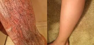 If your hair is too long, you can either lightly trim the area yourself—if waxing from home—or a waxing specialist will take care of this for you during your appointment. 23 Hair Removal Products That People Actually Swear By