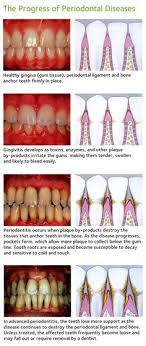 Check spelling or type a new query. 64 Dental Flipper Online Ideas Dental Flipper Dental World