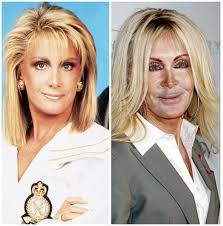 What's it like to go from being unattractive to gorgeous? Before After Plastic Surgery Photos Of 1950s Hollywood Stars Reelrundown