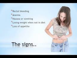 Russian journal of woman and child health. Colon Cancer Symptoms In Women Youtube