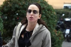 La donna, che ora ha 31 anni, è stata sottoposta a molti interventi per riavere il suo volto. Aggressione Con L Acido 15 Anni All Ex Di Gessica Notaro Tiscali Notizie