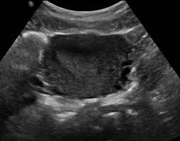 A test in which sound wave are used to examine internal structures. Point Of Care Pelvic Ultrasound Radiology Key