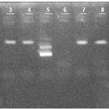 Panel A (izquierda): Filamentos branquiales secundarios no ramificados,... 