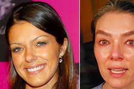 Adrianne Curry Bongkar Sisi Gelap Makeover Tyra Banks, Rambutnya Rusak  Permanen