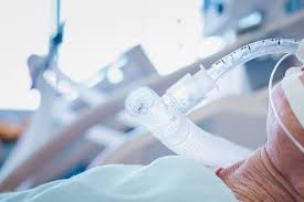 Using a smoke machine to find a compression leak. Majority Of Coronavirus Patients Put On Ventilators Don T Survive Shots Health News Npr