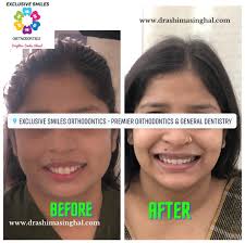 Exclusive Smiles Orthodontics