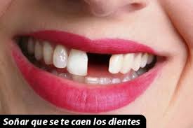 Significado De Sonar Que Se Te Caen Los Dientes No Te Imaginas