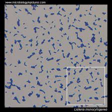 Start studying tissues under the microscope. Listeria Microscopy Listeria Gram Stain And Cell Morphology Listeria Micrograph Appearance Under The Microscope Listeria Cell Morphology Microscopic Picture Of Listeria