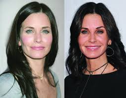 The stigma surrounding plastic surgery is disappearing as more mothers share their experiences, and why surg. Courteney Cox Regrets Her Plastic Surgery