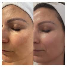 ✨Les miracles n'existent pas, les secrets de beauté oui... ✨ 3 mois  séparent ces deux photos de moi 🙏 ⚜️Mon teint est plus uniforme ⚜️Mes  tâches pigmentaires ont diminuées ⚜️Mes rougeurs se