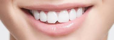 One ellipsoid and one rectangular attachment were exemplarily chosen and examined. Dentalbonding Abgeschlagene Zahne Reparieren Oral B
