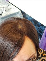Women S Bespoke Hair Systems Elite 9 Hair Clinic Nottingham