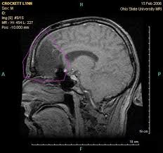 The scanning table has a maximum weight capacity of 425 to 450 pounds, while the gantry has a diameter of only 27.5 inches. Cancer Detection With Mri As Effective As Pet Ct Scan But With Zero Radiation Risks