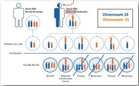 A robertsonian translocation involving chromosome 13 is when chromosome 13 is attached to another acrocentric chromosome (usually chromosome 14, 15, 21, or 22). Kv12 Zytogenetik 1 Flashcards Quizlet