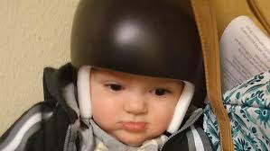 Fundraiser by Mark Skaggs : Medical helmet for Isaac Luke ⛑