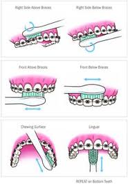 Available file formats are pdf, adobe swatch (ase) and photoshop swatch (aco). 56 Best Braces Color Ideas Braces Colors Braces Cute Braces