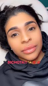 👄BEST BOCA 💋maker 💉on the block! ✨💋, 💋LIPS by:  @coconutaesthetics_nursecrystal , 👄Relleno de Labios 👄 hace que todo sea  más hermosa, ✨The benefits of Lip filler # is the gift that, keeps