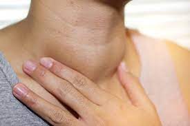 Đa số ung thư tuyến giáp là carcinôm biệt hoá tốt, tiến triển âm thầm, giai đoạn ẩn bệnh kéo dài, điều trị chính yếu là phẫu thuật. Bá»‡nh Ung ThÆ° Tuyáº¿n Giap Co Chá»¯a Khá»i Ä'Æ°á»£c Khong Vinmec