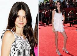 Maybe you would like to learn more about one of these? Kendall Dzhenner Do I Posle Plastiki Foto