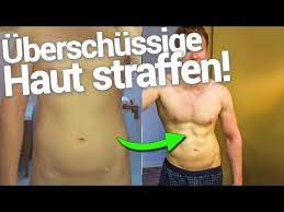 hautstraffung ohne operation spritzen oder skalpell ice aesthetic